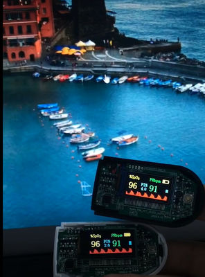 0.96'' Tft Lcd Display 4W SPI  80×160 Dots 13 Pin Nv3022b FSTN Transmissive