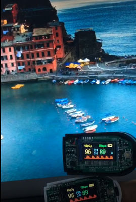 0.96'' Tft Lcd Display 4W SPI  80×160 Dots 13 Pin Nv3022b FSTN Transmissive